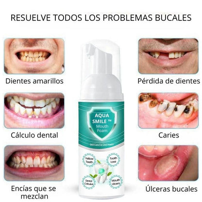 AQUA SMILE™️Combate todos los problemas bucales, no es una simple espuma blanquedora