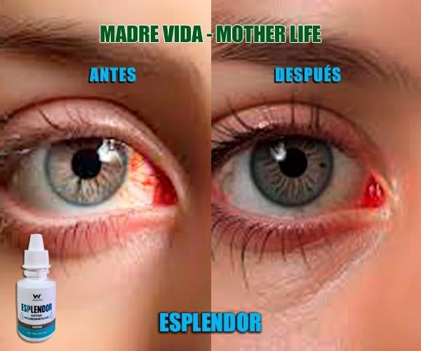 GOTAS ESPLENDOR™️ Lo mejor para tus ojos