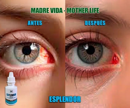 GOTAS ESPLENDOR™️ Lo mejor para tus ojos