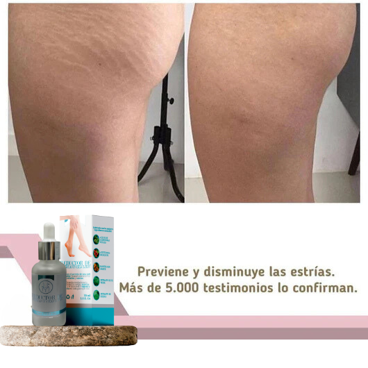 Serum reductor de estrías y celulitis®️ Resultados comprobados y garantizados