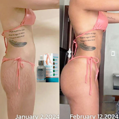Serum reductor de estrías y celulitis®️ Resultados comprobados y garantizados