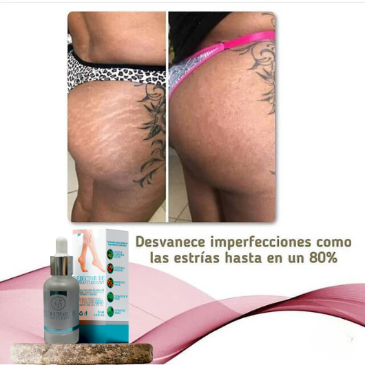 Serum reductor de estrías y celulitis®️ Resultados comprobados y garantizados