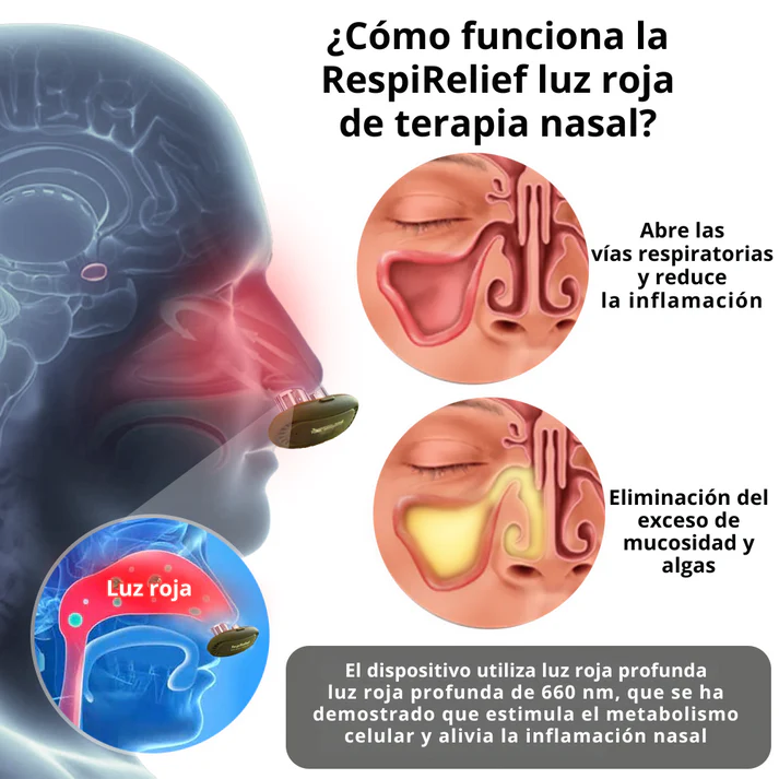 RespiRelief - Dispositivo de terapia nasal